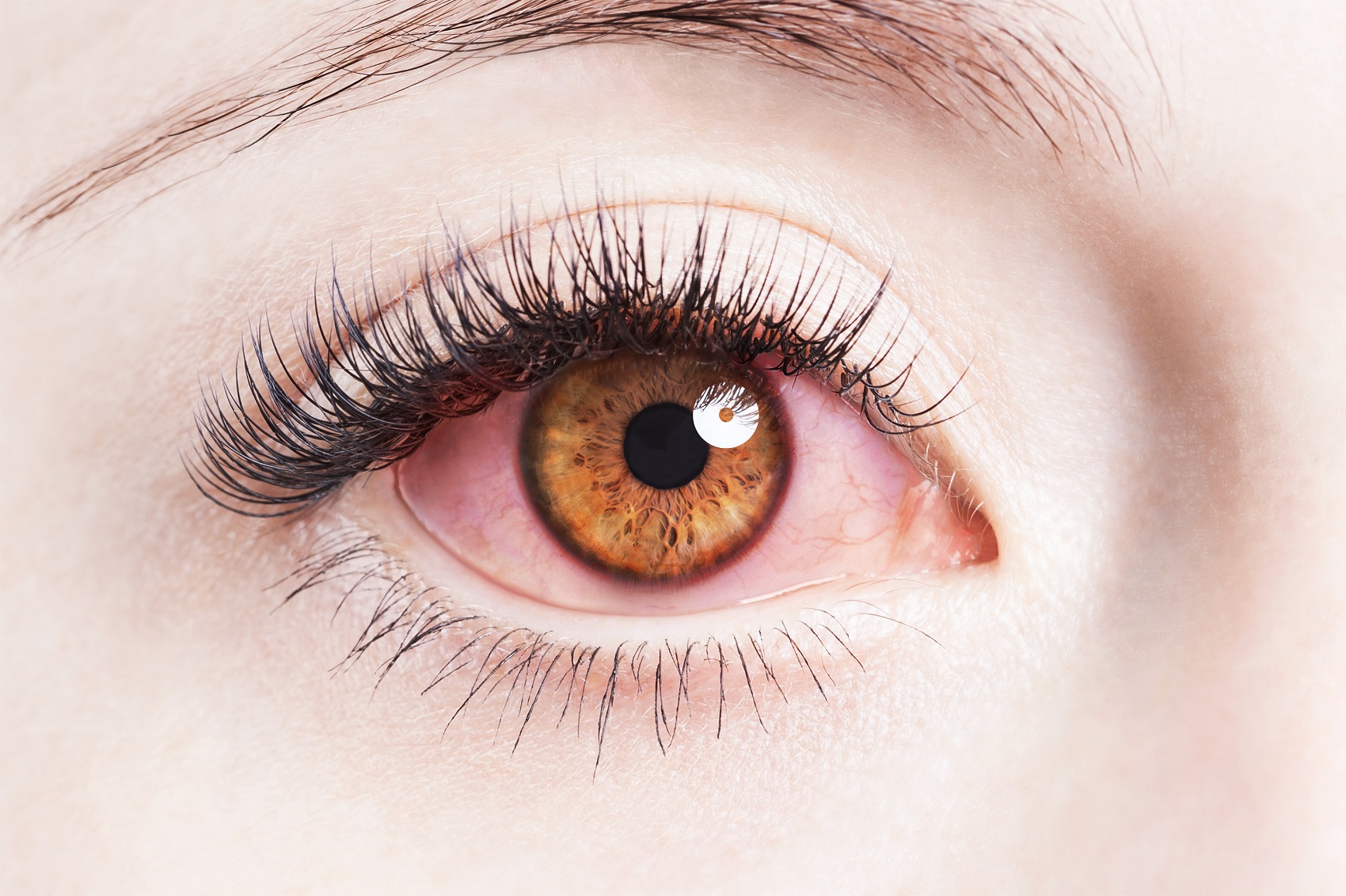 Alergia oczu – na co możemy mieć alergię?